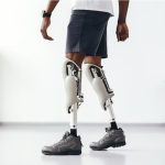 Advanced Tech Prosthetics