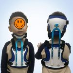 Head Orthoses
