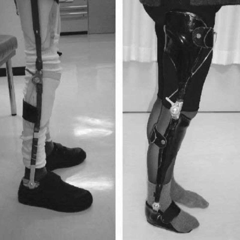 Long leg orthoses 3