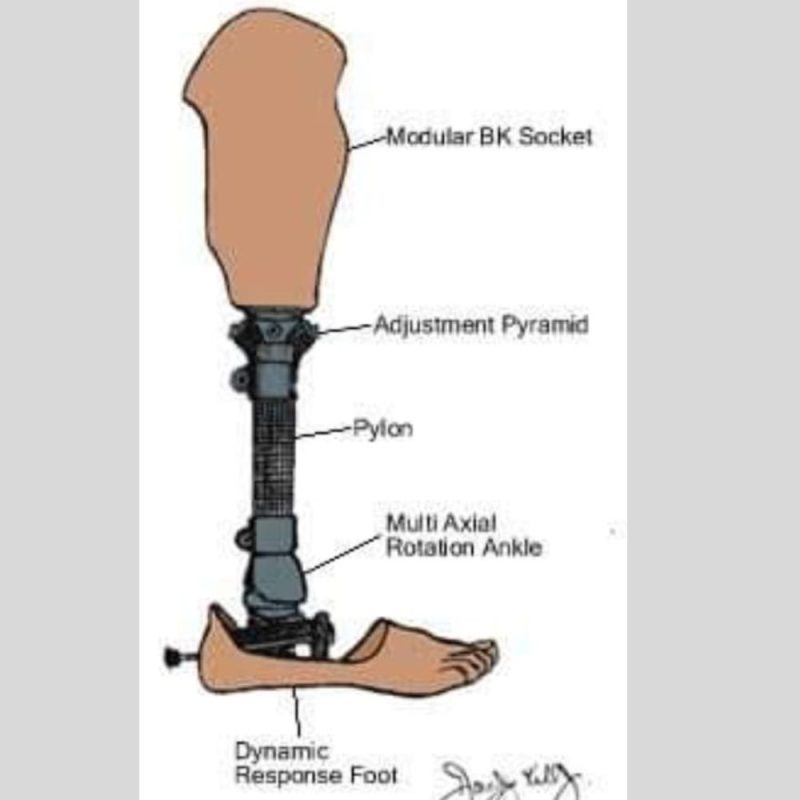 High technology prosthesis 2