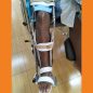 Long Leg Brace
