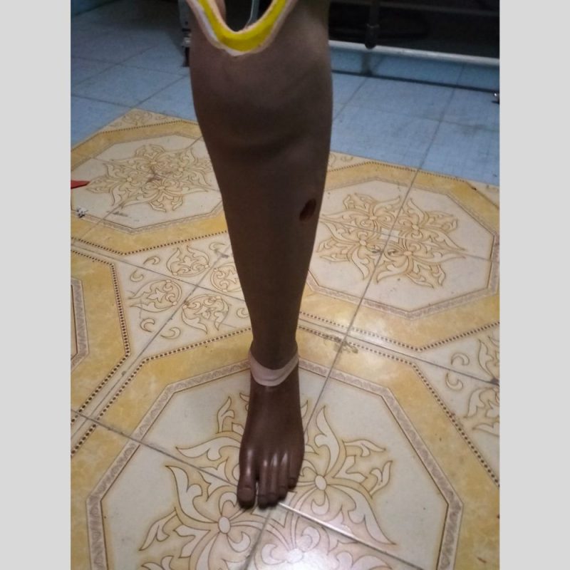 Prosthetic Foot 4